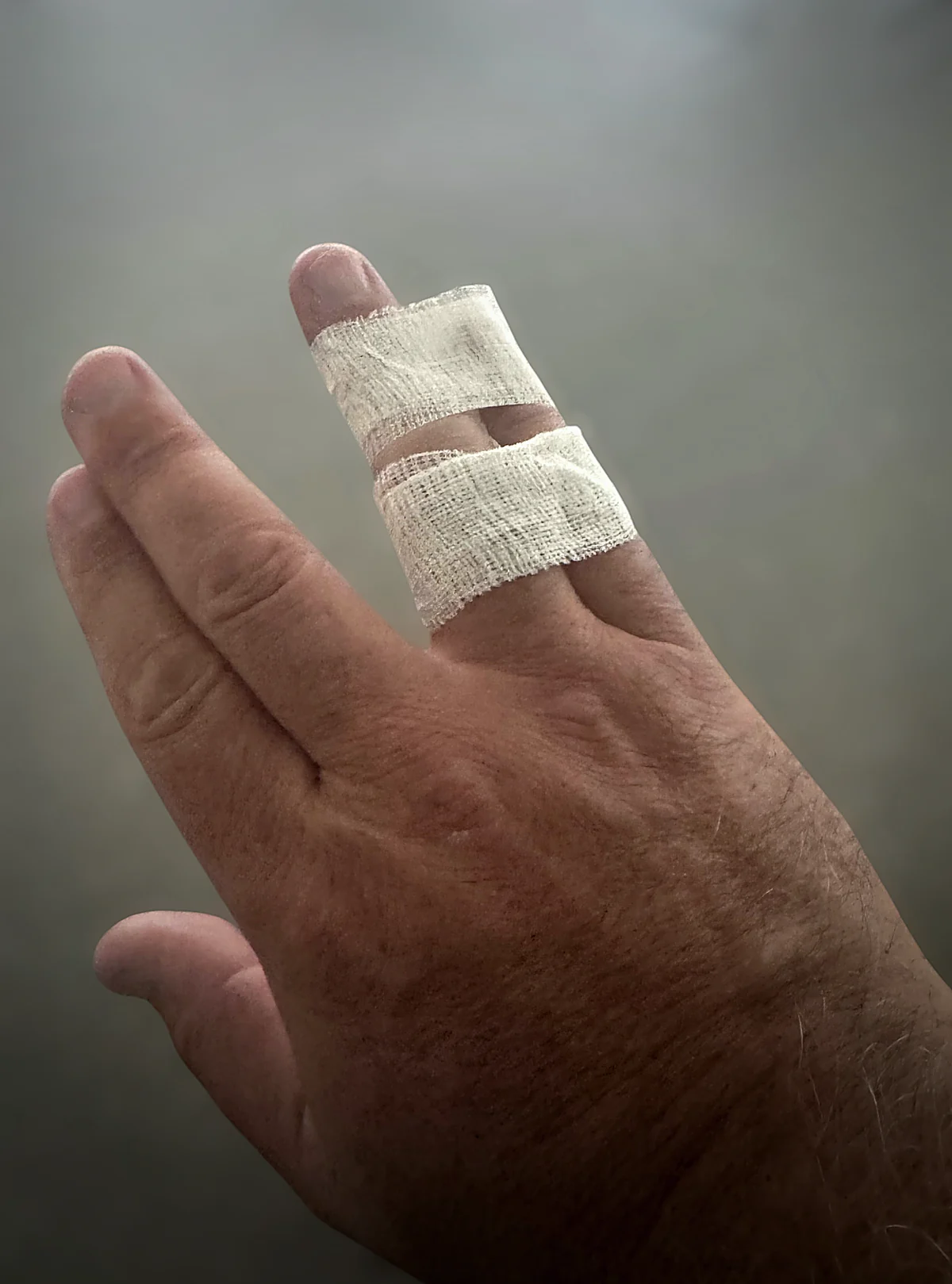 Two fingers buddy taped together with self-adhering tape, with bands above and below the middle joint and the fingertip left exposed